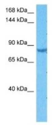 Western Blot: SORBS1 Antibody [NBP3-09956]