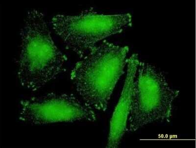 Immunocytochemistry/ Immunofluorescence: SORBS2 Antibody [H00008470-B01P]