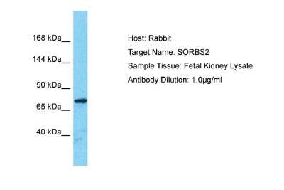 Western Blot: SORBS2 Antibody [NBP2-88335]