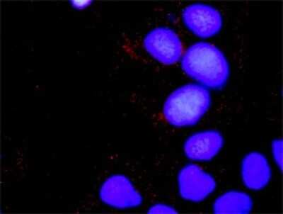 Proximity Ligation Assay: SOS1 Antibody (4C1) [H00006654-M01]