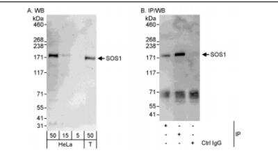 Western Blot: SOS1 Antibody [NBP1-05955]