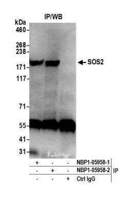 Immunoprecipitation: SOS2 Antibody [NBP1-05958]
