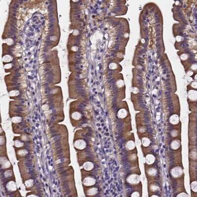 Immunohistochemistry: SOWAHA Antibody [NBP2-38055]