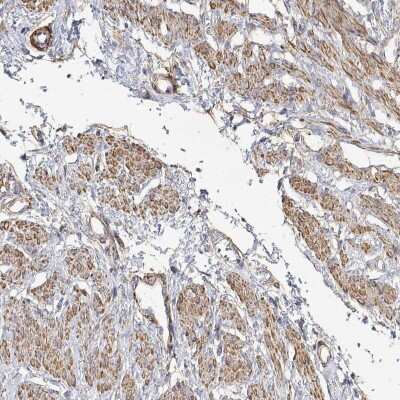 Immunohistochemistry: SOWAHD Antibody [NBP2-38081]