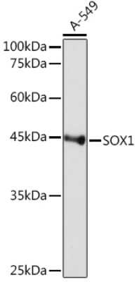 Western Blot: SOX1 Antibody (9L8Z4) [NBP3-16619]