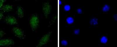 Immunocytochemistry/ Immunofluorescence: SOX1 Antibody (JJ20-40) [NBP2-67864]