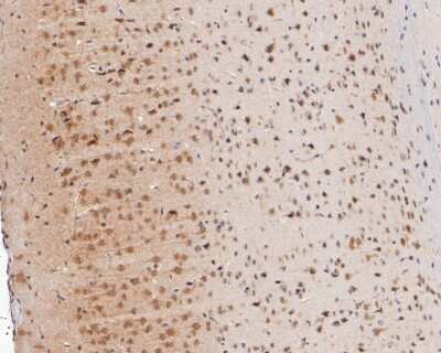 Immunohistochemistry-Paraffin: SOX1 Antibody (JJ20-40) [NBP2-67864]