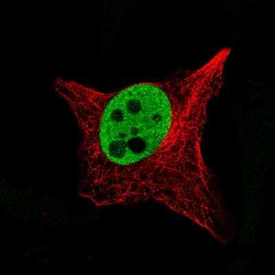 Immunocytochemistry/ Immunofluorescence: SOX10 Antibody (CL4455) [NBP2-59050]