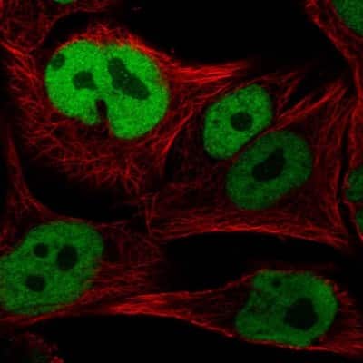 Immunocytochemistry/ Immunofluorescence: SOX10 Antibody [NBP2-57023]