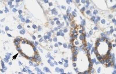 Immunohistochemistry-Paraffin: SOX10 Antibody [NBP1-68983]