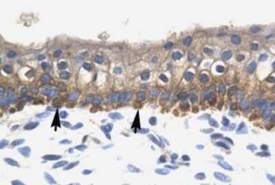 Immunohistochemistry-Paraffin: SOX10 Antibody [NBP1-68983]
