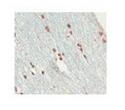 Immunohistochemistry-Paraffin: SOX10 Antibody [NBP1-68983]