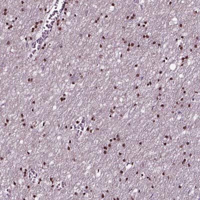 Immunohistochemistry-Paraffin: SOX10 Antibody [NBP2-57023]