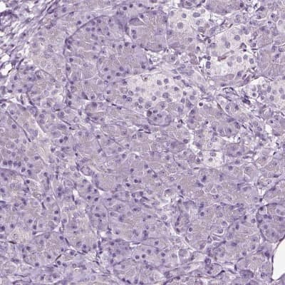 Immunohistochemistry-Paraffin: SOX10 Antibody [NBP2-57023]
