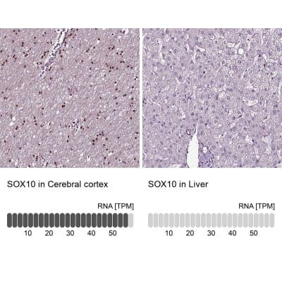 Immunohistochemistry-Paraffin: SOX10 Antibody [NBP2-57023]