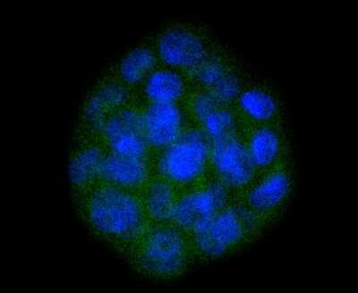 Immunocytochemistry/ Immunofluorescence: SOX10 Antibody (SD204-04) [NBP2-67812]