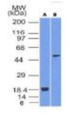 Western Blot: SOX10 Antibody (SOX10/1074) [NBP2-59622]