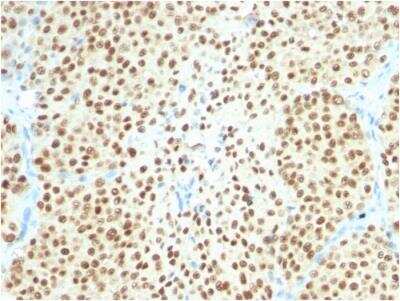 Immunohistochemistry-Paraffin: SOX10 Antibody (SOX10/2311R) - Azide and BSA Free [NBP2-79905]