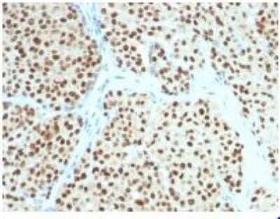 Immunohistochemistry-Paraffin: SOX10 Antibody (SOX10/991) - Azide and BSA Free [NBP2-59621]