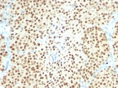 Immunohistochemistry-Paraffin: SOX10 Antibody (SPM607) [NBP2-44475]