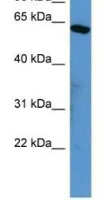 Western Blot: SOX10 Antibody [NBP1-68983]