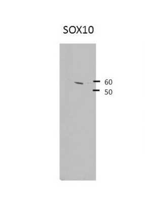 Western Blot: SOX10 Antibody [NBP1-68983]