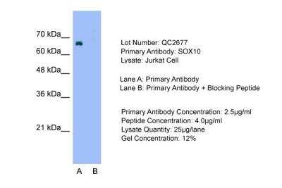 Western Blot: SOX10 Antibody [NBP1-68983]