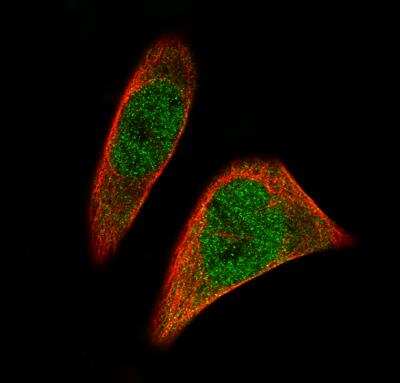 Immunocytochemistry/ Immunofluorescence: SOX11 Antibody (CL0142) [NBP2-14782]