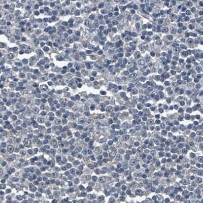 Immunohistochemistry-Paraffin: SOX11 Antibody (CL0142) [NBP2-14782]