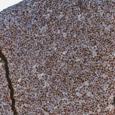 Immunohistochemistry-Paraffin: SOX11 Antibody (CL0142) [NBP2-14782]