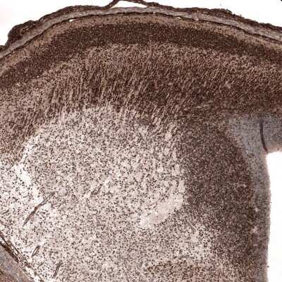 Immunohistochemistry-Paraffin: SOX11 Antibody (CL0142) [NBP2-14782]