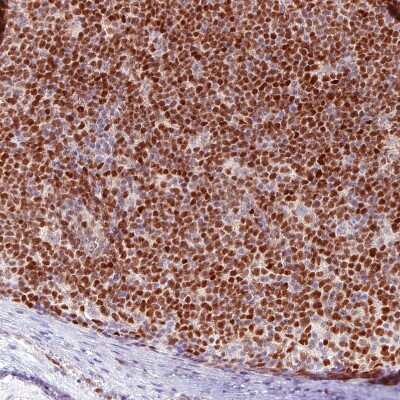 Immunohistochemistry-Paraffin: SOX11 Antibody (CL0143) [NBP2-52865]