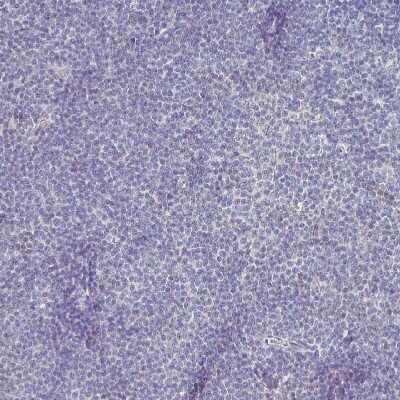 Immunohistochemistry-Paraffin: SOX11 Antibody (CL0143) [NBP2-52865]