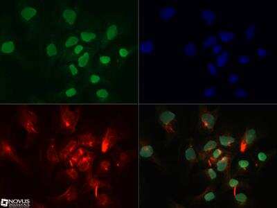 Immunocytochemistry/ Immunofluorescence: SOX11 Antibody [NBP2-31371]