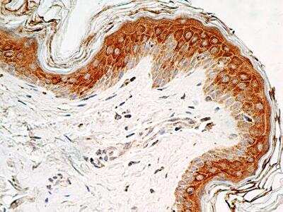 Immunohistochemistry-Paraffin: SOX11 Antibody [NBP2-31371]
