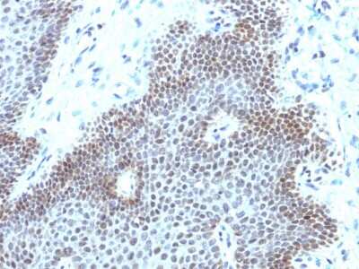 Immunohistochemistry-Paraffin: SOX11 Antibody (SOX11/3235R) [NBP3-07688]