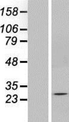 Western Blot: SOX14 Overexpression Lysate [NBP2-07901]