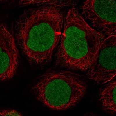 Immunocytochemistry/ Immunofluorescence: SOX15 Antibody [NBP2-38101]