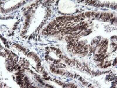 Immunohistochemistry: SOX17 Antibody (OTI2B6) - Azide and BSA Free [NBP2-74299]