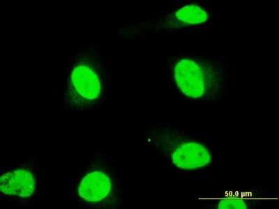 Immunocytochemistry/ Immunofluorescence: SOX18 Antibody (1C4) [H00054345-M05]