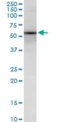 Western Blot: SOX18 Antibody (1C4) [H00054345-M05]