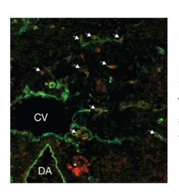 Immunocytochemistry/ Immunofluorescence: SOX18 Antibody [NBP3-10962]