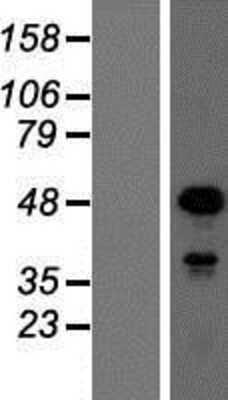Western Blot: SOX18 Overexpression Lysate [NBP2-06802]