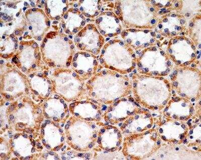 Immunohistochemistry-Paraffin: SOX2 Antibody (4G8) - BSA Free [NBP2-29623]