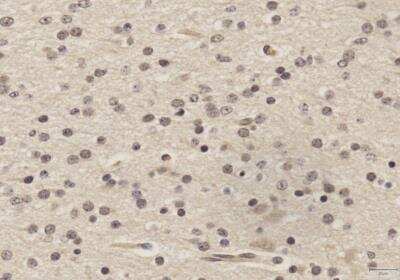 Immunohistochemistry-Paraffin: SOX2 Antibody (4G8) - BSA Free [NBP2-29623]