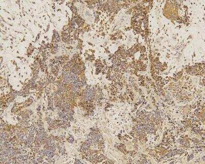 Immunohistochemistry-Paraffin: SOX2 Antibody (4G8) - BSA Free [NBP2-29623]