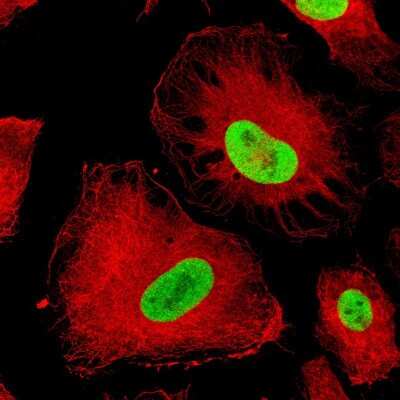 Immunocytochemistry/ Immunofluorescence: SOX2 Antibody (CL4716) [NBP2-59057]