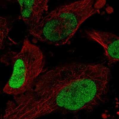 Immunocytochemistry/ Immunofluorescence: SOX2 Antibody [NBP2-58318]