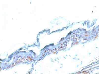 Immunohistochemistry-Paraffin: SOX2 Antibody (SOX2/1791) - Azide and BSA Free [NBP2-54594]
