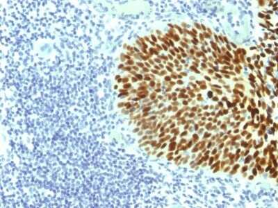 Immunohistochemistry-Paraffin: SOX2 Antibody (SOX2/1791) [NBP2-53407]